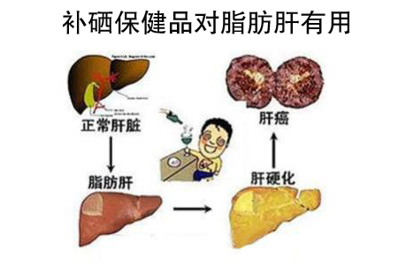 補硒保健品對脂肪肝有用