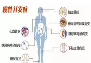 預防糖尿病并發癥記住一點穩定血糖